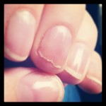 Nägel durchs Lackieren (Nagellack, Nagellackentferner) total kaputt und eingerissen