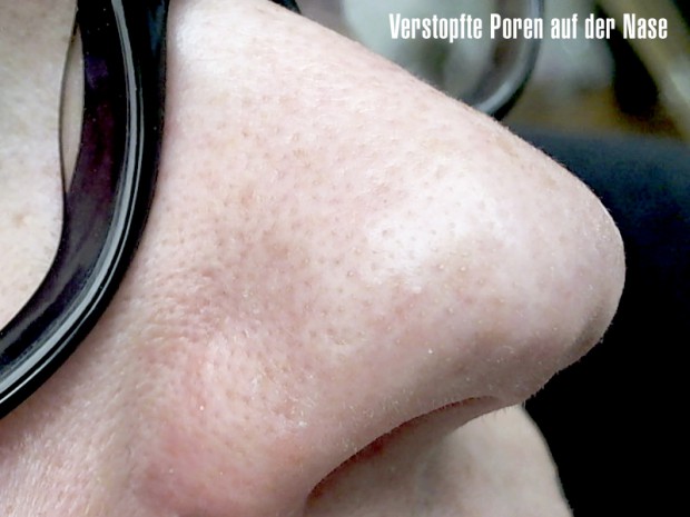 NIVEA Clear-up Strips Mitesser und verstopfte Poren säubern, reinigen, entfernen, ausreinigen