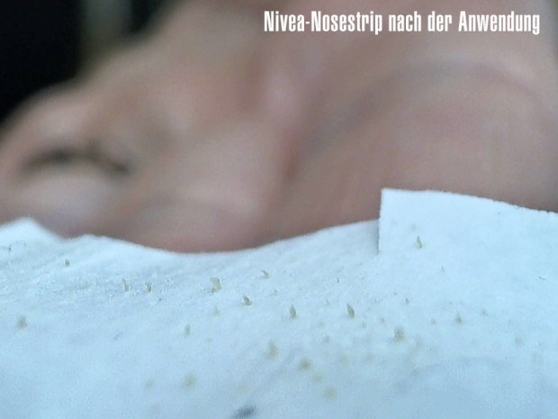 NIVEA Clear-up Strips Mitesser und verstopfte Poren säubern, reinigen, entfernen, ausreinigen